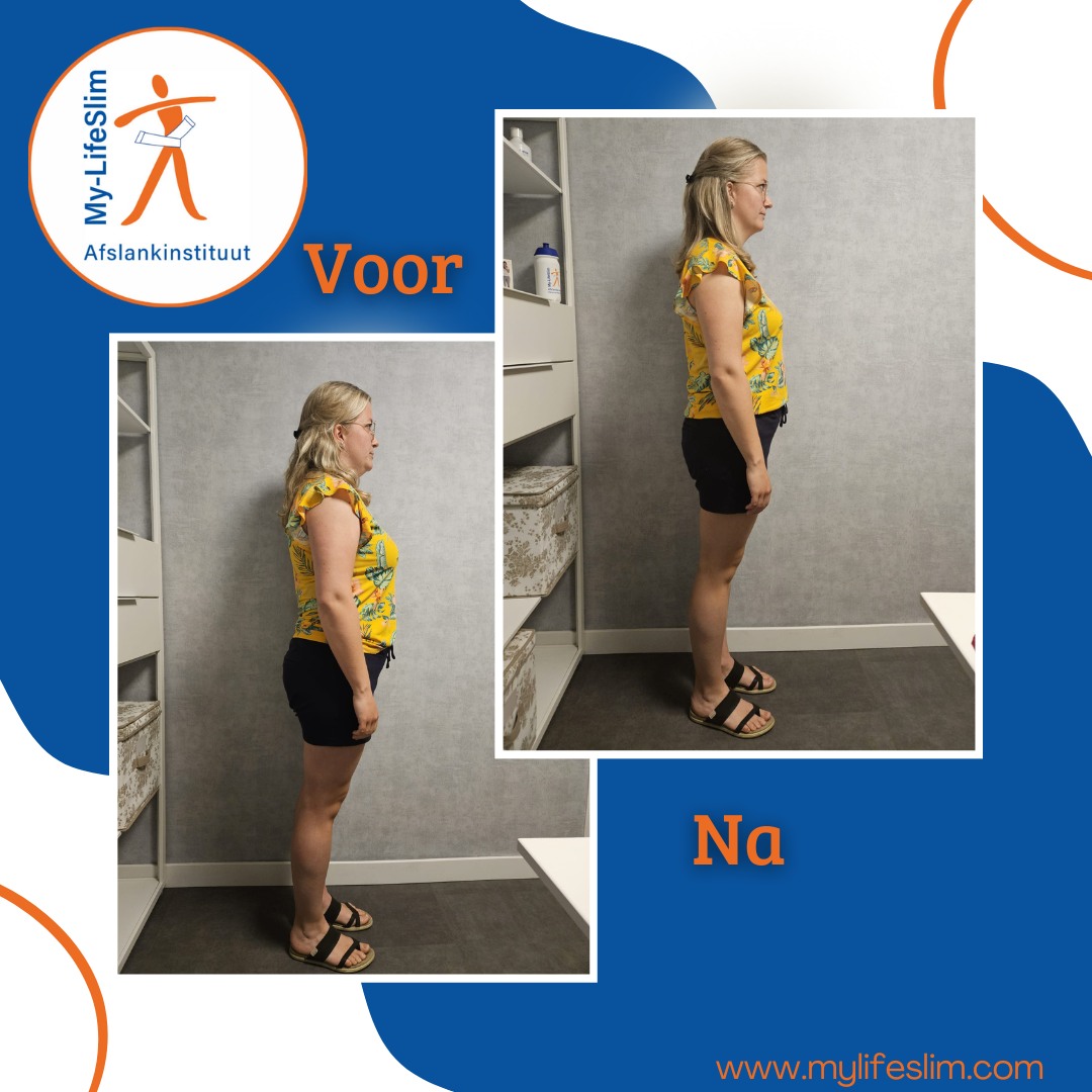 voor&naheemskermls